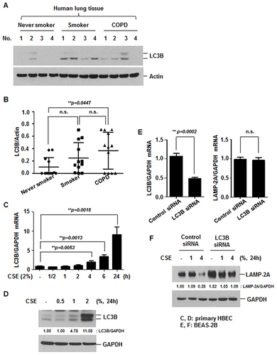 Figure 5 Downregulation of LAMP-2A is mediated by CSE-induced activation of macroautophagy. (A and B) Lung homogenates from never smokers (n = 12), smokers (n = 12), and COPD patients (n = 12) were subjected to Western blot analysis for LC3B and Actin (A). Gel data were quantified using Scion image densitometry (B). Data represent the mean ± SD. Normal versus smoker: p = 0.0827, normal versus COPD: **p = 0.0447. (C) Primary HBECs were stimulated with CSE (2%) for the indicated times. (D) HBECs were treated with CSE (0.5, 1 or 2%) for 24 h. The expression of LC3B was measured by quantitative real-time PCR. Data were normalized to the expression of GAPDH. Data represent the mean ± SD. Total cell lysates were subjected to Western blot analysis for LC3B and GAPDH. (E and F) BEAS-2B cells were transiently transfected with control siRNA and LC3B siRNA. Forty-eight hours after transfection, the cells were stimulated with CSE (1 or 4%) for 24 h. The expression of LC3B and LAMP-2A was measured by quantitative real-time PCR. Data were normalized to the expression of GAPDH. Data represent the mean ± SD (E). Total cell lysates were subjected to Western blot analysis for LAMP-2A and GAPDH (F).