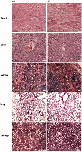 Figure 5. Representative photomicrographs of the heart, liver, spleen, lung and kidney sections (H&E staining) of rat of control group (a) and treated with test CHSPNs (b).