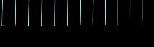 Figure 7. Results of parking lines detection (paintings are represented as blue areas).