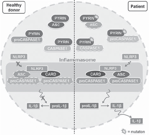 Figure 1. Mechanism of pyrin action in the pathogenesis of familial Mediterranean fever (FMF). Pyrin is known to play a key role in NLRP3 inflammasome inhibition by a competitive binding either of ASC or procaspase-1/caspase-1. FMF-associated pyrin mutations, which lead to inflammasome activation by decreased interaction of pyrin with the specific substrates, result in abnormal interleukin-1β production.