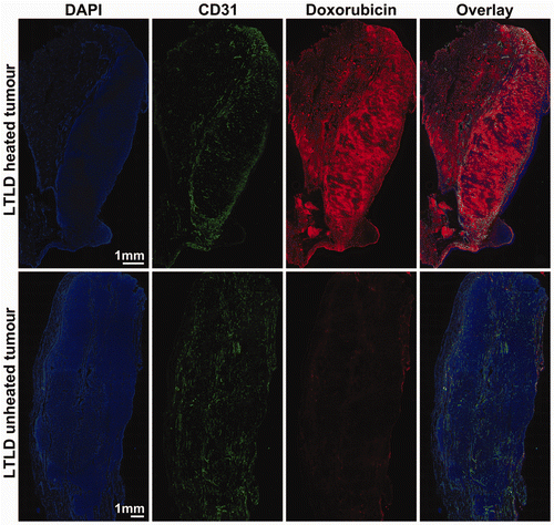 Figure 4. Microregional distribution of doxorubicin in heated and unheated tumours. Rabbits with VX2 tumours implanted in both thighs were treated with MRI-controlled focused ultrasound hyperthermia in one tumour during intravenous infusion of thermosensitive liposomal doxorubicin. Tumours were harvested 2 h after infusion and then sectioned, stained and tiled at 10× magnification. Composite images of heated and unheated tumours from one animal display DAPI staining of cell nuclei in blue and background-subtracted doxorubicin fluorescence in red with CD31-stained endothelial cells identifying tumour vessels in green.