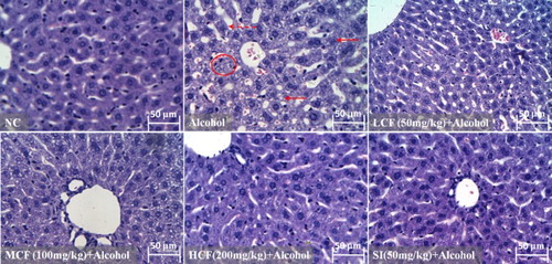 Figure 7. Effect of C. fructus on alcohol-induced histopathological changes in the livers of mice (original magniﬁcation 400×).