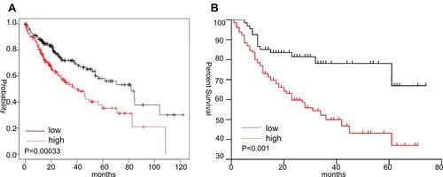 Figure 4 Survival analysis in HCC patients with high or low SLC41A3 expression. (A) High expression of SLC41A3 is associated with poor survival (Kaplan–Meier Plotter database). (B) Kaplan–Meier survival curves of HCC patients recruited in the present study with high or low SLC41A3 expression show that the higher was the expression of SLC41A3 in cancer tissues, the lower was the survival rate.