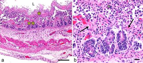 Figure 5. Naturally-acquired necrotic enteritis caused by C. perfringens type C in a neonatal piglet. A. Diffuse necrosis of mucosa (**), which is covered by a pseudomembrane (*) that is composed mostly by fibrin, cell debris and inflammatory cells. These effects are a consequence of CPB (see text). The intestinal lumen is indicated (L). B. This higher magnification of image A shows thrombosis of mucosal vessels (↗) and myriad neutrophils admixed with fibrin and cell debris forming a pseudomembrane (*) on the surface of the necrotic mucosa (**). Scale bar=50 μm. Hematoxylin and eosin