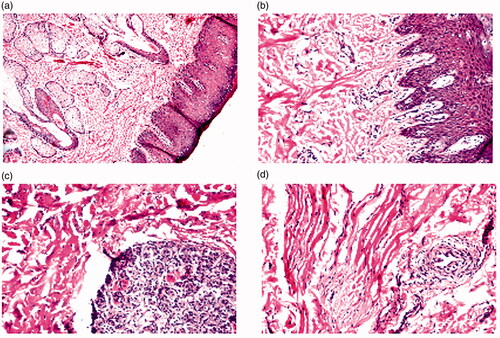 Figure 5. Photomicrographs showing histopathological sections of the anterior parts of sheep nasal mucosa treated with PBS pH 7.4 (negative control, a) and M5 (optimized CLZ-loaded PNMS, b). And the posterior parts of sheep nasal mucosa treated with PBS pH 7.4 (negative control, c) and M5 (optimized CLZ-loaded PNMS, d).