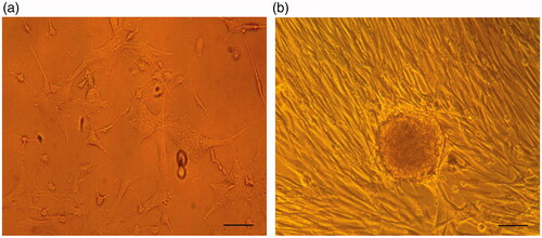 Figure 1. Morphological changes of cultured cells in TCPS group. (a) hiPSCs in DMEM (control group). (b) hiPSCs in IPCs differentiation media at day-21. Scale bars are 100 µm.