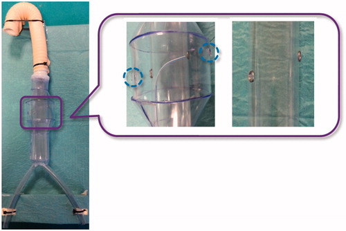 Figure 7. In vitro set-up. A global view of the aorta simulator is shown on the left and a zoom detail showing the plastic tube inserted into the aorta mannequin to simulate the stent graft is shown on the right. Two metal rings are used to indicate the target fenestration sites aligned to the simulated renal ostia (highlighted with blue dotted circles). Note that the plastic tube has no holes at the metal rings.