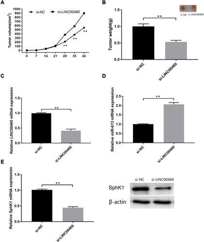 Figure 7 LINC00460 knockdown inhibited in vivo xenograft tumour growth. (A) Tumour volume and (B) tumour weight changes in the mice bearing HT29 cells with si-NC or si-LINC00460 transfection. (C) qRT-PCR analysis of LINC00460 expression levels in the isolated tumour tissues. (D) qRT-PCR analysis of miR-613 expression levels in the isolated tumour tissues. (E) qRT-PCR analysis of SphK1 mRNA and protein expression levels in the isolated tumour tissues. N = 3.**p < 0.01.