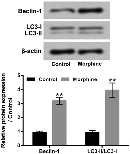 Figure 2. Morphine promoted HT22 cell autophagy. HT22 cells were exposed to 10 µM morphine for 24 h. The Beclin-1 and LC3 protein levels were tested by western blotting. **p ˂ 0.01.