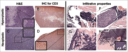 Figure 3. Histological thymic alterations in KM mice. (A) The cortex is expanded by a heterogeneous (hyperplastic) lymphoid cell population, with retention of the normal thymic architecture in a 1-month-old KM mouse. (B) The architecture of the hyperplastic thymus in a 1-month-old KM mouse is maintained, with the majority of CD3 immunopositive cells in the cortex. (C) The normal architecture of the thymus is completely effaced by a lymphoid round cell neoplasm in a 2.5-month-old KM mouse. (D) Neoplastic lymphoid cells effacing the thymus in a 2.5-month-old KM mouse are diffusely CD3 immunopositive, consistent with T-cell origin of the neoplasm. (E-G) H&E staining of nearby tissues. (E) Neoplastic cells invade adjacent adipose tissue. (F) Neoplastic cells encircling ganglia. (H) Neoplastic cells invade the myocardium at the base of the heart (G) Neoplastic cells invade the musculature of the sternum. All insets show to neoplastic cells at 400X.