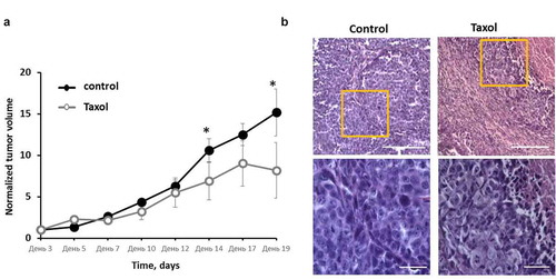 Figure 5. Effects of Taxol on HeLa-SypHer2 tumors in mice. (a) Tumor volume dynamics in response to Taxol. Mice of the treated group (○) were administered i.p. with 10 mg/kg Taxol, starting from Day 3 (6 doses for 2 weeks in total). Control mice (●) received PBS on the same days. Mean ± SEM, n = 8 tumors. Tumor volumes from individual mice were normalized to the values measured on Day 3. *, statistically significant difference from control tumors, p ≤ 0.05. (b) Post-treatment histopathology of HeLa-SypHer2 tumors. H&E-staining. Enlarged regions are indicated by the yellow squares on the lower-magnification panel (210 × 280 μm, original magnification ×20). Higher-magnification images (60 × 80 μm, original magnification ×40) are shown on the lower panel. Bar is 100 μm for the lower panel and 200 μm for the upper panel