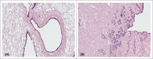 Figure 10. H&E staining of recellularized non-frozen (A) and frozen/thawed (B) decellularized ECM with human RCTE cells after 12 d. Both non-frozen and frozen/thawed decellularized ECM showed the potential to support proliferation of human cells.