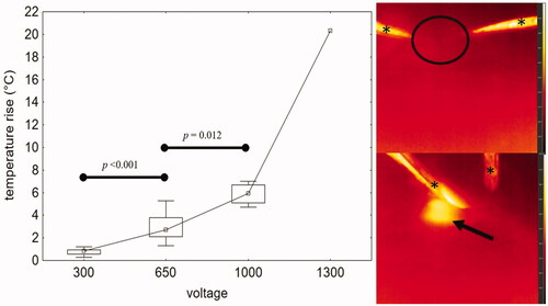 Figure 6. Left – graph demonstrating temperature rise during the IRE procedure in relation to voltage (scenarios A and B together), marked increase of measured temperature was recorded at 650 and 1000 V. Right – thermographic images demonstrating thermal changes before (up) and after (down) ablation in liver tissue surrounding the IRE catheter: scenario A, 1000 V, temperature increase from basal temperature 21.2 °C (circle) to 27.8 °C (arrow) immediately after ablation. Thermographic scale 18.0 °C to 28.0 °C. *Represent surgical tweezers.