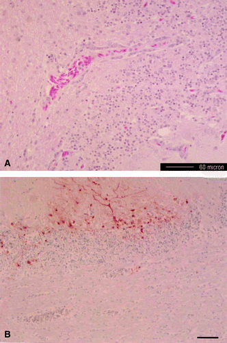 Figure 2. Photomicrograph of the cerebellum from a dead duck. 2A: focal mononuclear perivascular cuffs with gliosis in the neurophil. Haematoxylin & eosin stain. Bar = 60 µm. 2B: viral antigen detected in the Purkinje neurons, dendrites and granular cell layer. Immunohistochemical stain with haematoxylin counterstain. Bar = 75 µm.