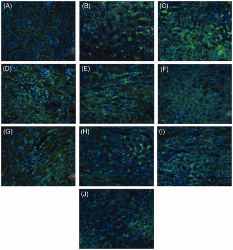 Figure 4. BK expression in kidney – by immunofluorescence [FITC]. (A) Blank control; (B–E) TCE + group at 24 h, 48 h, 72 h and Day 7, respectively; (F) solvent control group; (G–J) PKSI + group at 24 h, 48 h, 72 h and Day 7, respectively. Magnification 200×.