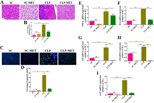 Figure 1. Metformin attenuated CLP-induced liver inflammation and injury in aged rats. (A,B) H&E staining showed significantly increased inflammatory infiltration, oedema, and haemorrhage of liver tissues in the CLP group than SC and SC-MET groups, whereas these abnormalities were markedly reduced in the CLP-MET group (bar = 50 μm; n = 3/group). (C,D) TUNEL assay results in four groups showed that the hepatocyte apoptosis increased in the CLP group and decreased in the CLP-MET group (n = 3/group). (E-I) The RT-PCR experiment showed that compared with SC and SC-MET groups, the expression of inflammatory factors TNF-α, IL-6, and chemokines ccl2, cxcl1, and ccl4 were elevated in the CLP group and decreased in the CLP-MET group. *P < 0.05, **P < 0.01, ***P < 0.001 (n = 3/group).