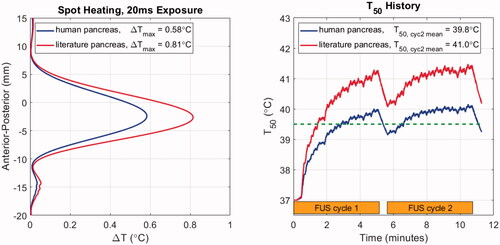Figure 7. Temperature elevation simulation results with patient model M1 using literature and newly acquired human pancreas acoustic properties. Left: Anterior-posterior (depth) temperature distribution in the lateral center of the target after 20 ms of exposure, with the peak values listed in the legend. Right: T50 histories over two treatment cycles indicated by orange bars. Cycle-2 mean T50 values are listed in the legend. The dashed green line indicates the threshold temperature for drug release from ThermoDox™.