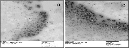 Figure 4. Transmission electron microscopic images of freshly prepared F1 and F2 formulations (Mag. 68800).