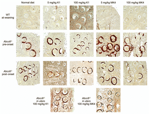 Figure 4 Histological evaluation of calcification in the vibrissae of WT and Abcc6-/- mice. Connective tissue calcium deposition was observed with Alizarin S Red staining in mice fed with either normal diet, or diet enriched in vitamin K1 or vitamin MK4 at 5 or 100 mg/kg. Sections of the muzzle skin were taken from each mouse from all mouse diet treatment groups. Mouse diets are described as ‘pre-onset’ of phenotype consist of mice fed with the diet from ∼day 21 for 16 weeks. ‘Post-onset’ corresponds to mice fed from ∼3 months of age (already possessing the calcification phenotype) for 12 weeks. In utero mouse samples were taken from mice which, when in utero, had mothers fed with the relevant diet and continued with the diet, through breast feeding and weaning up until 5 months of age. Size of hair follicle and depth of sections cut into the tissue were used as a guide to match relevant WT and Abcc6-/- sections. We observed no difference in placement or extent of calcium deposition. The same amount of staining occurred in the capsule surrounding the vibrissae in the whiskers in the Abcc6-/- mice fed control or either of the two vitamin K enriched diets.
