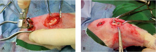 Figure 21. Peroperative view. A) The femur screw is placed. B) Prior to closure. Three screws in situ placed in the knee region, one in the distal condylar femur region and two in the proximal tibia.