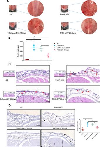 Figure 6 Preserved GelMA-sEV complex promoted angiogenesis in the subcutaneous fascial layer of C57BL/6J mice. (A) General view of angiogenesis in the subcutaneous fascial layer in different groups on 6th day after treatment.NC, negative control. (B) Total length of new vessels in the fascial layer from each groups, n = 4. (C) Representative HE-stained images of angiogenesis in the subcutaneous fascial layer (red arrows: new vessels with erythrocytes) Scale bar = 50µm. (D) Immunohistochemical staining of CD31-positive endothelial cells in each groups was used to visualize vessels. CD31-positive endothelial cells were quantified from 5 independent visions per sample (black arrows: CD31 positive endothelial cells) Scale bar = 50 µm, n = 4. The significance (A and D) was tested with one-way ANOVA with Tukey posthoc test. (*p < 0.05, **p < 0.01, ***p < 0.001).