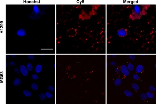 Figure 7 Cellular internalization in H1299 and MG63 cells.Note: Scale bar =25 μm.