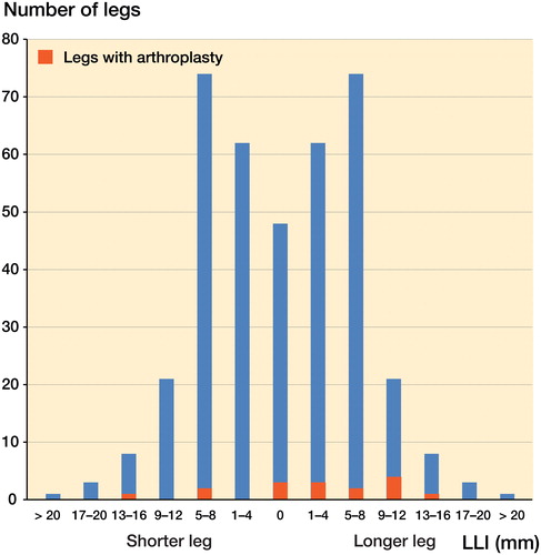 Figure 2. Relationship of arthroplasties and LLI. Left of center (0) is the shorter leg, and to the right is the longer leg. The blue columns show legs in different LLI categories. The red columns show the number of performed arthroplasties in each category. 10 of the operations were carried out on the longer leg.