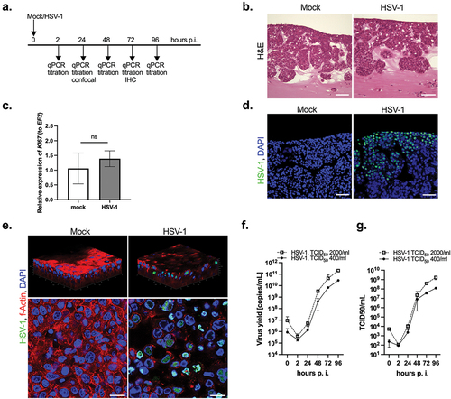 Figure 4.  HSV-1 infection of the 3D gingival model. The OTG model was exposed to the mock or virus to allow virus adsorption and penetration. (a) Schematic representation of the experiment. (b) The morphology of the OTG model infected with HSV-1 was investigated using H&E staining; scale bar, 100 μm. (c) HSV-1 infection of the OTG model has no influence on Ki67 mRNA expression measured by qPCR. Data represent mean ± SD of at least three replicates; ns, not significant. (d) Immunofluorescence staining with a HSV-1 antibody was performed to evaluate infection of the OTG model with the pathogen (virus, green; nuclei, blue; scale bar, 50 μm). (e) 3D confocal visualization was constructed from a z-stack comprising 200 images of the OTG model. Mock- and virus-infected cultures were costained with an anti-HSV-1 antibody (green), phalloidin (actin, red), and DAPI (nuclei, blue) at 24 h p.i.; scale bar, 20 μm. A single optical slice of the OTG model showed virus particles inside the nuclei of TIGKs. Replication kinetics of HSV-1 in the OTG model analyzed by qPCR (f) or titration (g). The OTG model was infected with two doses of the virus: TCID50 400 and 2000/mL. Data points represent qPCR results or TCID50 of cell culture supernatants harvested at the indicated times p.i. Data are presented as HSV-1 DNA copies/mL (f) or TCID50/mL (g). Mean ± SD, n = 3.