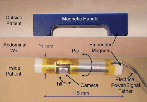 Figure 1. Overview of first-generation peritoneum-mounted imaging robot system. [Color version available online.]