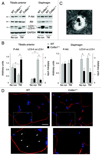 Figure 4. Treadmill exercise induces autophagy in wild-type muscle but not in Col6a1–/– mice. (A) Western blot analysis for Akt phosphorylation and LC3 lipidation in TA (left) and diaphragm (right) muscles from 5-mo-old wild-type and Col6a1–/– mice housed in standard conditions (no run) or after 1 h treadmill exercise (TM). (B) Densitometric quantifications of P-Akt levels and LC3-II vs LC3-I ratio, as determined by western blots of TA (left) and diaphragm (right) (*p < 0.05, n = 3). (C) Electron micrograph of double-membrane (arrowheads) autophagosome in TA of wild-type mice after treadmill exercise. Scale bar, 200 nm. (D) Fluorescence microscope analysis of cryosections of TA from wild-type;GFP-LC3 and Col6a1–/–;GFP-LC3 mice after treadmill exercise. GFP-LC3 puncta (green fluorescence) are abundant in wild-type muscle fibers, but they are scarce and poorly detectable in Col6a1–/– myofibers. Immunohistochemistry for laminin (red fluorescence) was performed to reveal myofiber outline, while Hoechst staining (blue) was used to label nuclei. The lower panels are higher magnifications of the squared areas, clearly showing GFP-LC3 puncta (arrowheads) in wild-type but not in Col6a1–/– myofibers. Scale bar, 25 μm. TM, treadmill; WT, wild-type.