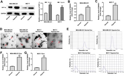 Figure 1 SNHG1 is upregulated in exosomes derived from hypoxic breast cancer cells. MDA-MB-231 and MCF-7 cells were cultured for 24 h under hypoxia or normoxia. (A) Western blot analysis of HIF-1α level in MDA-MB-231 and MCF-7 cells. (B and C) RT-qPCR analysis of SNHG1 level in MDA-MB-231 and MCF-7 cells. (D and E) Identification of exosomes derived from MDA-MB-231 and MCF-7 cells by TEM and NTA analysis. Exosome was indicated by the red arrow. (F and G) RT-qPCR analysis of SNHG1 level in exosomes derived from MDA-MB-231 and MCF-7 cells. Each experiment was repeated in triplicate (n=3). **P<0.01 vs Normal group.