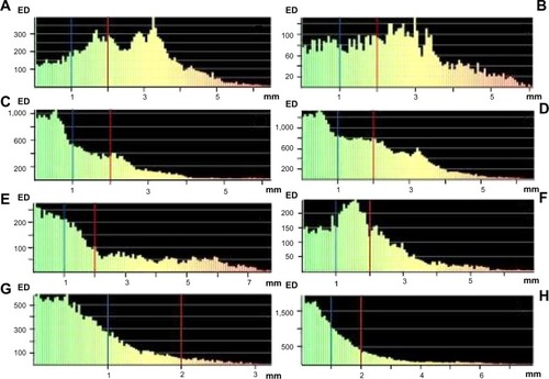 Figure 6 Surface-deviation analysis for the position of the mandible reconstruction with the iliac crest bone flap and osteomyocutaneous fibula flap.