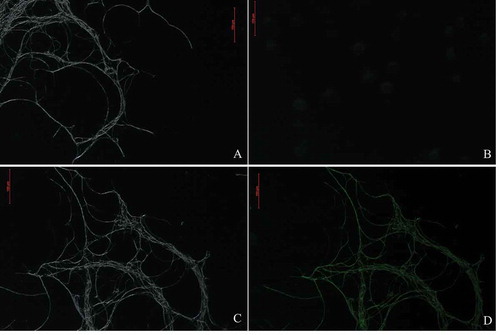 Fig. 3 Green fluorescent of the WT strain, HS2 (a, b), and a transformed strain, HS2-2483 (c, d), of Fusarium oxysporum. A and C represent the bright field; B and D represent the fluorescent field