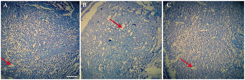 Figure 8. Luxol fast blue staining of the three groups; autograft (A), conduit group (B) and Conduit + NGF group (C) at the end of 12th week postsurgery (×20). (Arrows: vacuole degeneration).