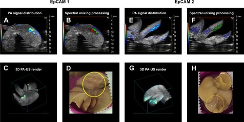 Figure 8 PA signal distribution (A, E), spectral unmixed algorithm processing (B, F), and 3D PA-US renders reconstructed by 145 slices of 150 µm thickness (C, G), and the photos of samples (D, H), for EpCAM 1 and EpCAM 2, respectively. The yellow circles were placed on the tumor regions where signal was acquired. In the PA unmixed images (B, F), the spatial distribution of nanoparticles is represented in green color, deoxy-hemoglobin chromophores in blue color, and oxy-hemoglobin chromophores in red color; gray scalebar for ultrasound signal intensity, colored scalebar for PA signal intensity.Abbreviations: EpCAM, epithelial cell adhesion molecule; PA, photoacoustic; US, ultrasound.