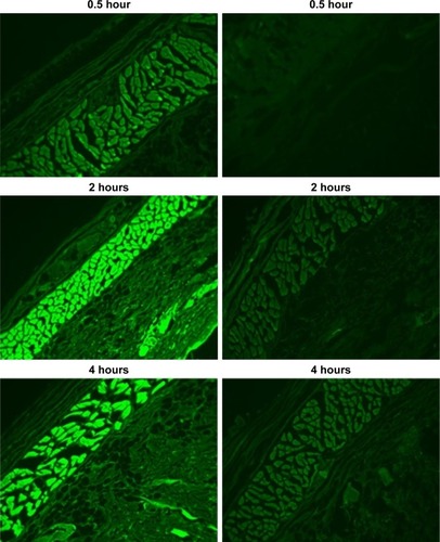 Figure 5 Visualization of skin penetration of the optimized TPGS-ALA-loaded transdermal (left column) and control (right column) films after 0.5, 2, and 4 hours using fluorescence laser microscope (magnification 400×).Abbreviations: ALA, alpha lipoic acid; TPGS, D-α-tocopherol polyethylene glycol 1000 succinate.