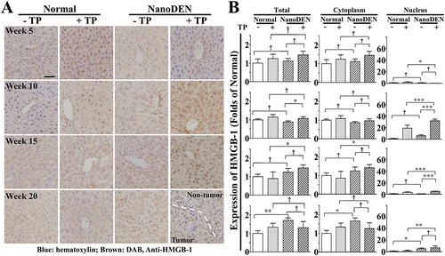 Figure 4 Nuclear expression of HMGB-1 was significantly elevated after TP injection in nanoDEN-treated mice.