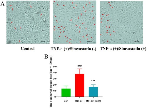 Figure 2. Profiles of cell morphology (200× magnification). Pseudopod increased in the TNF-α treatment, relative to the control group, while pseudo foots were significantly lower in the TNF-α combined with simvastatin relative to the TNF-α alone group (red arrows). Contrast phase microscope 100×. B: Analysis of the number of pseudo foot in each group. Error bars represent SD, n = 6, ###P < 0.001 versus the control group, ***P < 0.001 versus the TNF-α treatment group. Bar = 100 μm.