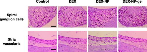 Figure 4. Histological observation of spiral ganglion cells and stria vascularis in the mice cochlea. There are no significant changes in spiral ganglion cells. H&E, spiral ganglion cells: bar = 40 µm, and stria vascularis: bar = 20 µm.