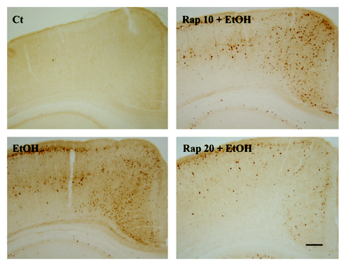 Figure 7. Effect of ethanol and rapamycin on caspase-3 activation in the developing brain. PD7 mice were injected with ethanol (0 or 5 g/kg) and/or rapamycin (10 mg/kg or 20 mg/kg, Rapa: 10 or 20). The expression of active CASP3/caspase-3 in the cerebral cortex was examined 8 h after the injection by immunohistochemistry as described under Materials and Methods. Scale bar: 100 μm. The experiment was replicated three times.