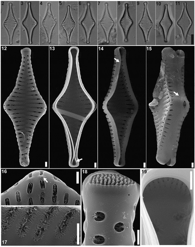 Figs 2–19. Pseudostaurosira australopatagonica sp. nov., type material (LPC 15861a. Laguna Pescado, Santa Cruz Province, Argentina). Figs 2–11. LM of type material, valve views. Fig. 5. Holotype specimen. Figs 12–19. SEM images. Fig. 12. External valve view. Fig. 13. Internal valve view with an open girdle band still attached (arrow). Figs 14–15. Tilted specimens in internal valve view, showing mantle plaques at the abvalvar margin of the valve (arrows). Fig. 16. Detail of areolae with profusely dichotomously branched volae, internal view. Fig. 17. Detail of areolae with profusely dichotomously branched, internal view. Fig. 18. Detail of the apical pore field, external view. Fig. 19. Detail of the apical pore field, internal view. Scale bar: Figs 2–11, 10 µm; Figs 12–17, 10 µm; Figs 18–19, 500 nm