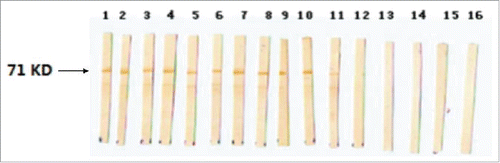 Figure 2. Detected the antigenicity of rBCG-EgG1Y162 by Western blots. M: Protein Marker, lanes 1 to 16: 1–6 serums from rabbits infected by Eg, 7–11 from patients infected by Eg and 12–16 from 5 normal serum samples as negative controls. All of serum samples were diluted 200-fold with PBS.