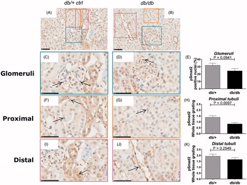 Figure 3. pSmad2 immunostaining in db/+ vs. db/db mice. Representative IHC sections from db/+ control mice (A, C, F, I) and db/db mice (B, D, G, J). Quantification of pSmad2 (E, H, K). (A) and (B) are shown at 40X magnification where the black-line = 50uM. (C) and (D) show a glomeruli structure at 80x magnification, (F) and (G) show a PTEC structure at 80x magnification and (I) and (J) shows a DTEC structure at 80x magnification. Arrows indicate positively stained nuclei structure indicative of active signaling. (E) shows glomeruli quantification. (H) and (K) show PTEC and DTEC quantification. Values shown as means ± SEM.