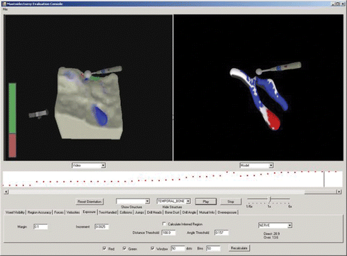 Figure 6. Reviewing a procedure in the performance evaluation console study. Members of the Feedback Group received interactive feedback about their maintenance of visibility with red (poor) and green (good) dots as bone was drilled away and a meter showing the percentage of red and green voxels over the last 50 removals, as shown in the video replaying in the left panel. After completing a trial, they were able to review their performance with respect to visibility, exposure/overexposure, and collisions with the tube. Shown at right is a visualization of achieved exposure, with properly exposed regions in white, overexposed regions in red, and unexposed regions in blue. [Color version available online.]
