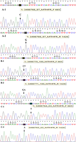 Figure 2 Results of DNA sequencing of the MTHFR C665T gene polymorphism.