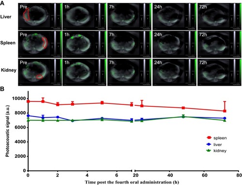 Figure 5 Signal of SWCNHox in liver, spleen and kidney following multi-dose (four doses) oral administration. (A) Optoacoustic images of the liver, spleen and kidney after total 200 µg SWCNHox oral administration. (B) The photoacoustic signals in the liver, spleen and kidney before the first administration and after the fourth oral gavage administration of SWCNHox.