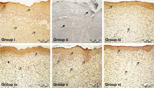 Figure 11 Effect of aqueous fraction of Moringa oleifera on vascular endothelial growth factor expression showing relative brown stain indicated by the black arrows in wound tissue of treated diabetic rats in skin wound tissues 21 days postwounding.