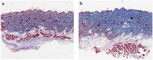Figure 4. Rat skin histopathological changes of collagen with Masson staining (100 fold) Masson staining was used to observe collagen fibers (blue stained part was collagen fibers) a. Rat skin in NS group on the 28th day. b. Rat skin in PRP group on the 28th day