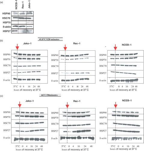 Figure 2. Expression level of hsp27, hsp70, Hsc70, and hsp90 by western blot analysis in an equal number of Jeko-1, Rec-1, and NCEB-1 cells at the physiological growth temperature of 37°C (a). Kinetics of expression of hsp27, hsp70, Hsc70, and hsp90 in Jeko-1, Rec-1 and NCEB-1 after exposure to a mild thermal dose (41.8°C/120 min) (b), and to 44°C/30 min (c). ß-actin was used as a protein loading control. After heat treatment at the selected thermal doses cells were allowed to recover in a humidified atmosphere at 37°C for up to 48 h. At the time points 4, 16, 24 and 48 h an equal numbers of cells were harvested for western blot analysis. Control cells were kept at 37°C (left column of each panel).