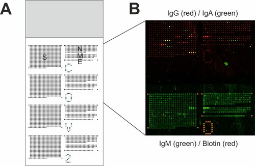 Figure 1. Slide layout and exemplary data of fluorescent signals obtained for sample ID f. (A) Each slide holds 2592 peptide sequences and 86 biotin control spots arranged in four sub-grids. Each sub-grid contains 648 15mer peptides with an offset of three amino acids to the next peptide, encompassing the whole sequences of S, N M, and E protein derived from ref. seq. NC_045512. (B) Bound antibodies against SARS-CoV-2 peptide sequences were visualized with isotype-specific anti-human secondary antibodies coupled to different fluorescent dyes or fluorescently labelled streptavidin. In one sub-grid, IgG (red) and IgA (green) antibodies were detected. Antibodies bound to the same peptide sequences produce yellow signals as overlay of red and green signals. In the adjacent sub-grid, IgM (green) and biotin (red) were detected.